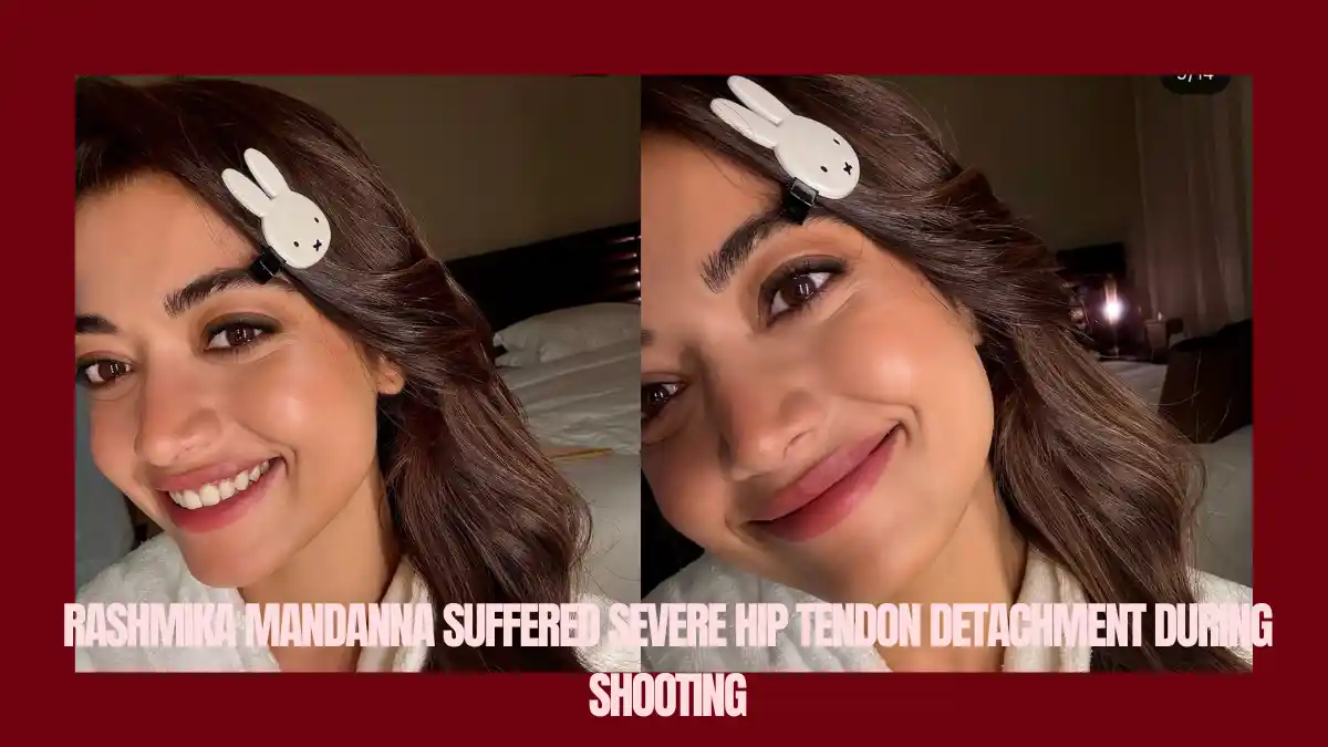 Rashmika Mandanna Injury रश्मिका मंदाना चोट