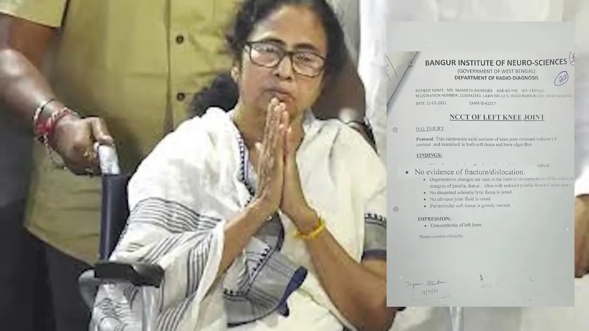 Mamata Banerjee medical report leak Suvendu Adhikari legal notice